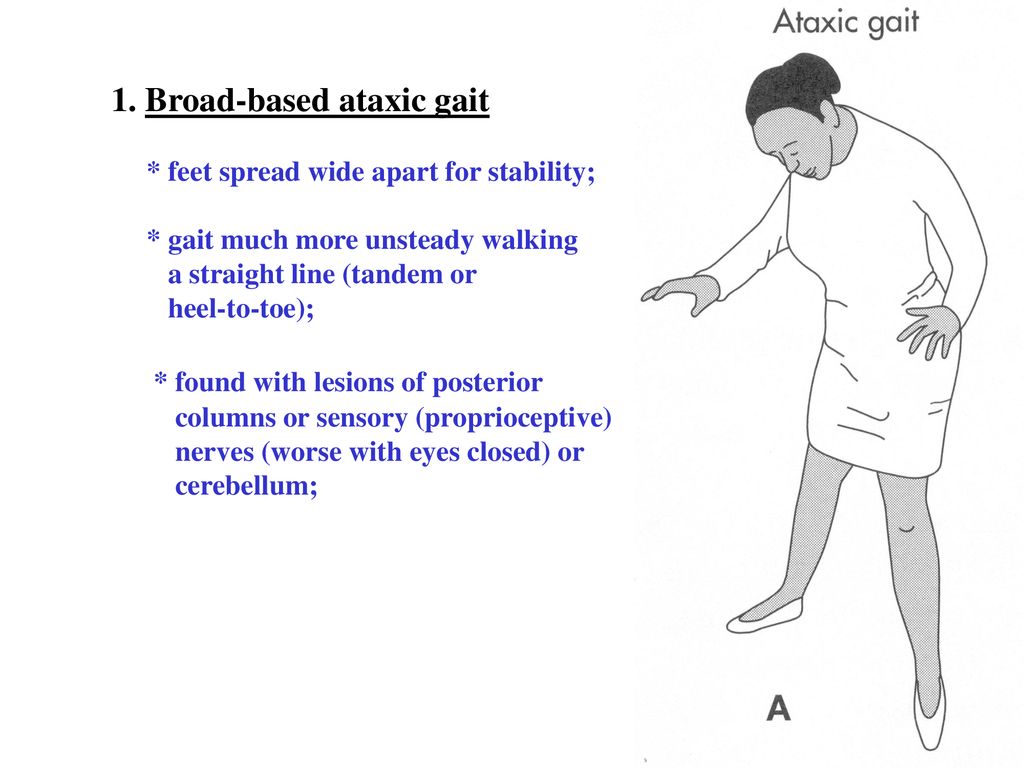 Michael P Merchut Md Professor Ssom Department Of Neurology Luhs Ppt Download