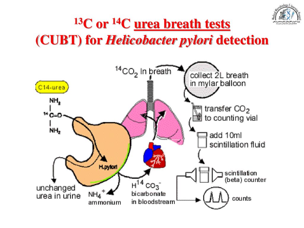 Анализ хеликобактер дыхательный подготовка. Helicobacter pylori Breath Test. Test for h.pylori. C Breath Test больше 50. Urea breathing Test.