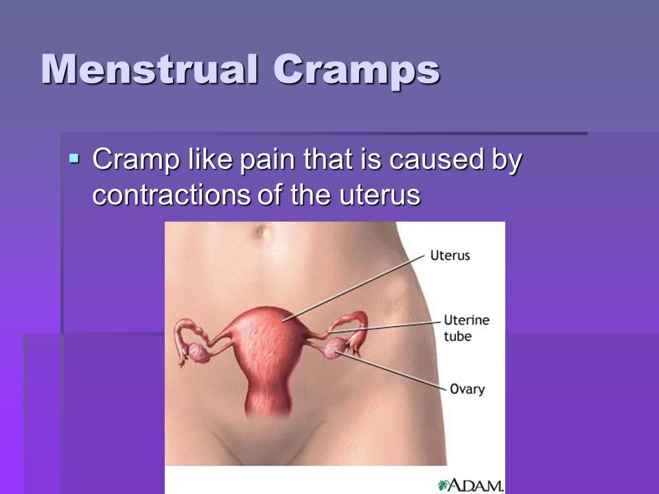 Menstrual Cramps Cramp like pain that is caused by contractions of the uterus