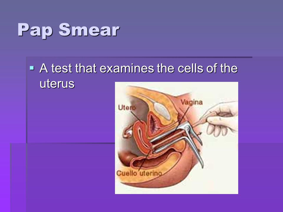 Pap Smear A test that examines the cells of the uterus