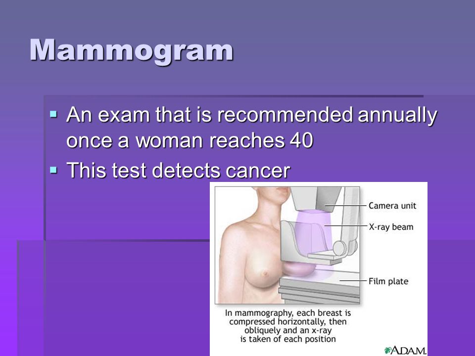 Mammogram An exam that is recommended annually once a woman reaches 40