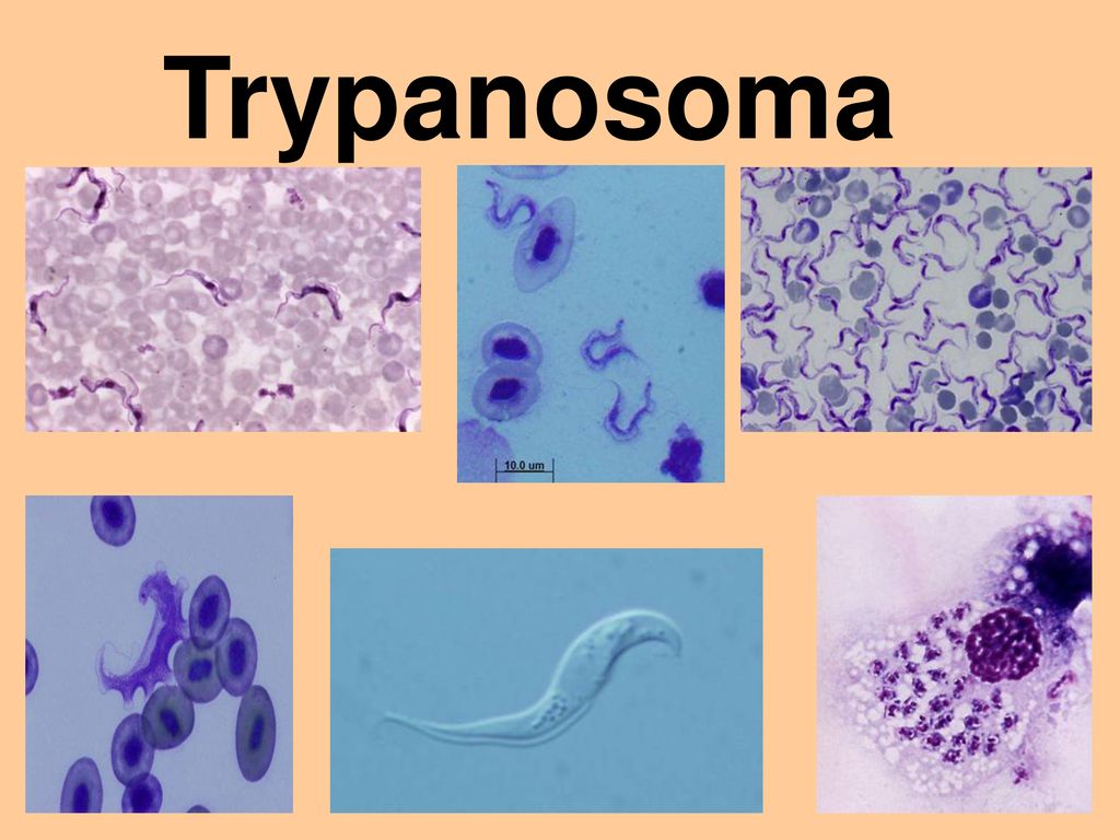 Trypanosoma Ppt Download