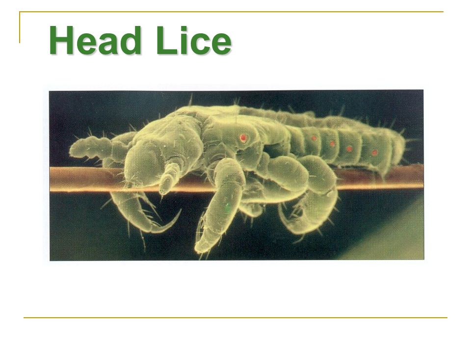 Head Lice Dos géneros de piojos infestan al ser humano: