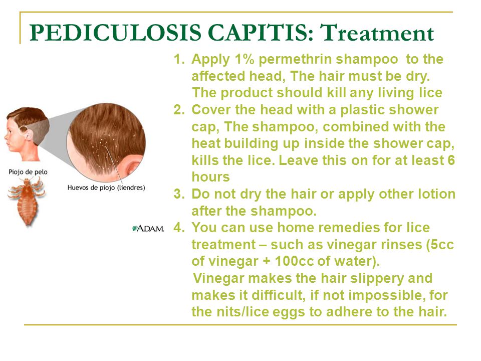 PEDICULOSIS CAPITIS: Treatment