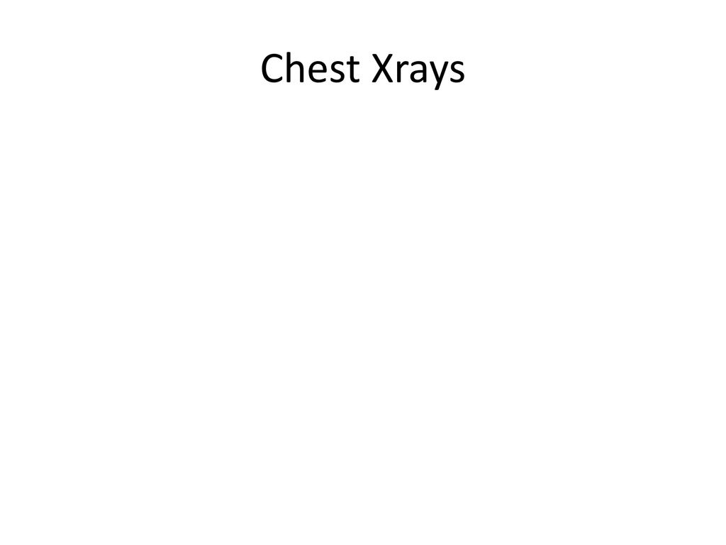 Chest Xrays