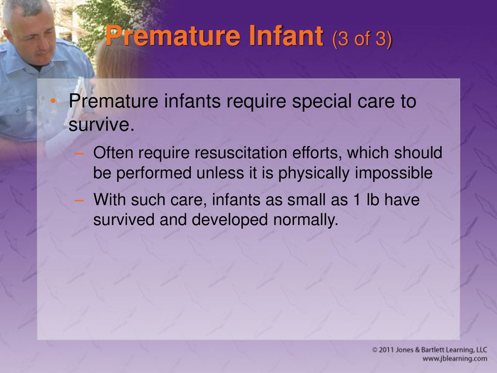 Premature Infant (3 of 3) Premature infants require special care to survive.