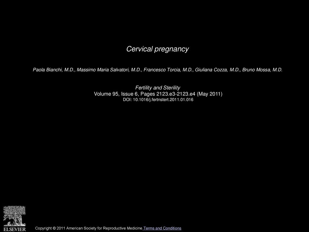 Cervical pregnancy Fertility and Sterility