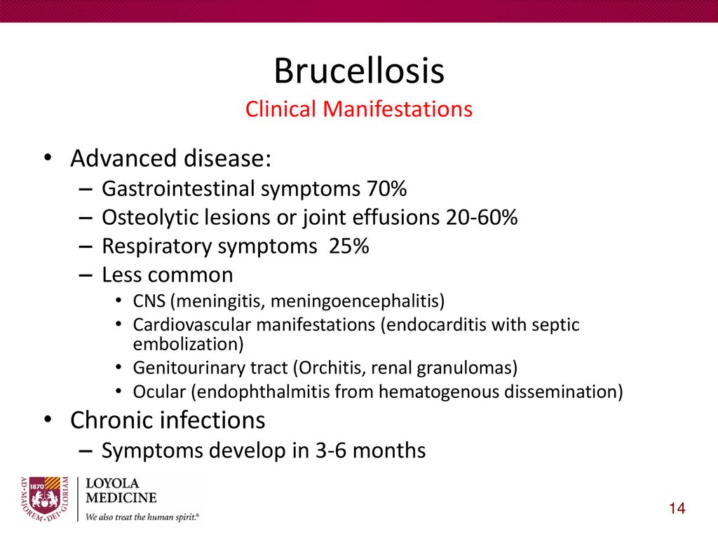 Bacterial Zoonoses SSOM-MHD Amanda T. Harrington, PhD, D(ABMM) - ppt ...