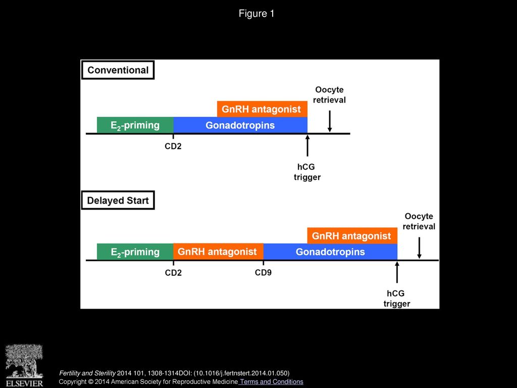 A novel “delayed start” protocol with gonadotropinreleasing hormone