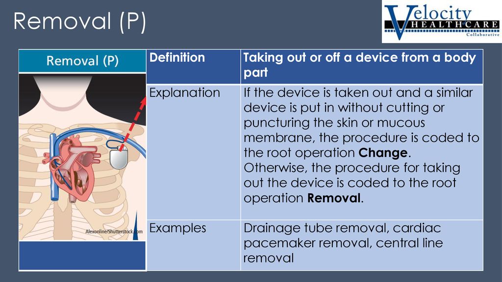 Taking Out Or Off A Device From A Body Part