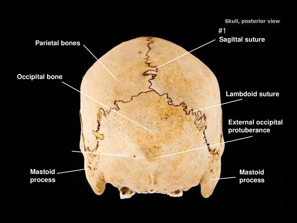 Теменная кость является костью. Sagittal Crest. Лобная кость фото. Mastoid notch. Additional Suture of the occipital Bone.