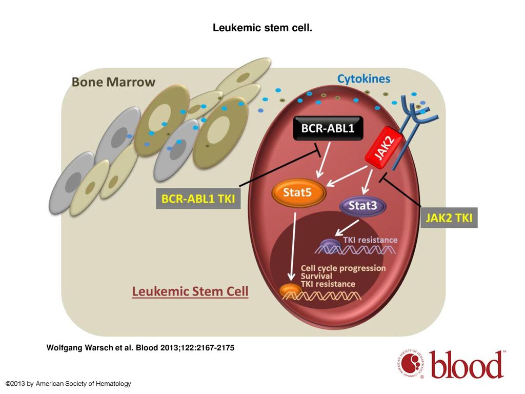 Leukemic stem cell.