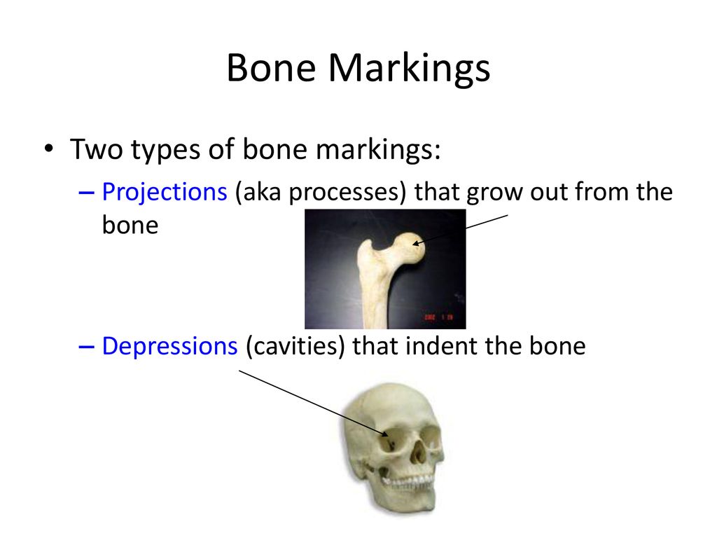 Bone Markings. - ppt download