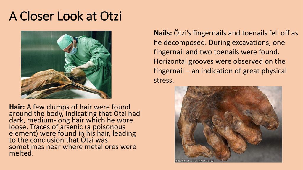 Otzi The Iceman Ppt Download