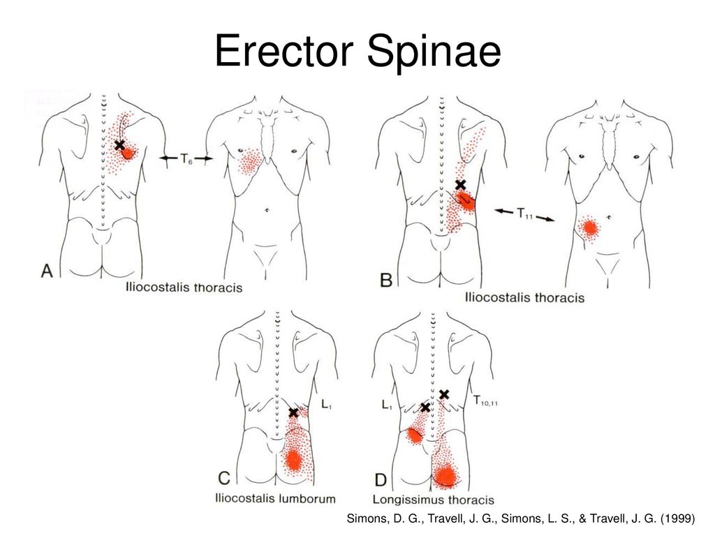 travell and simons transverse abdominis