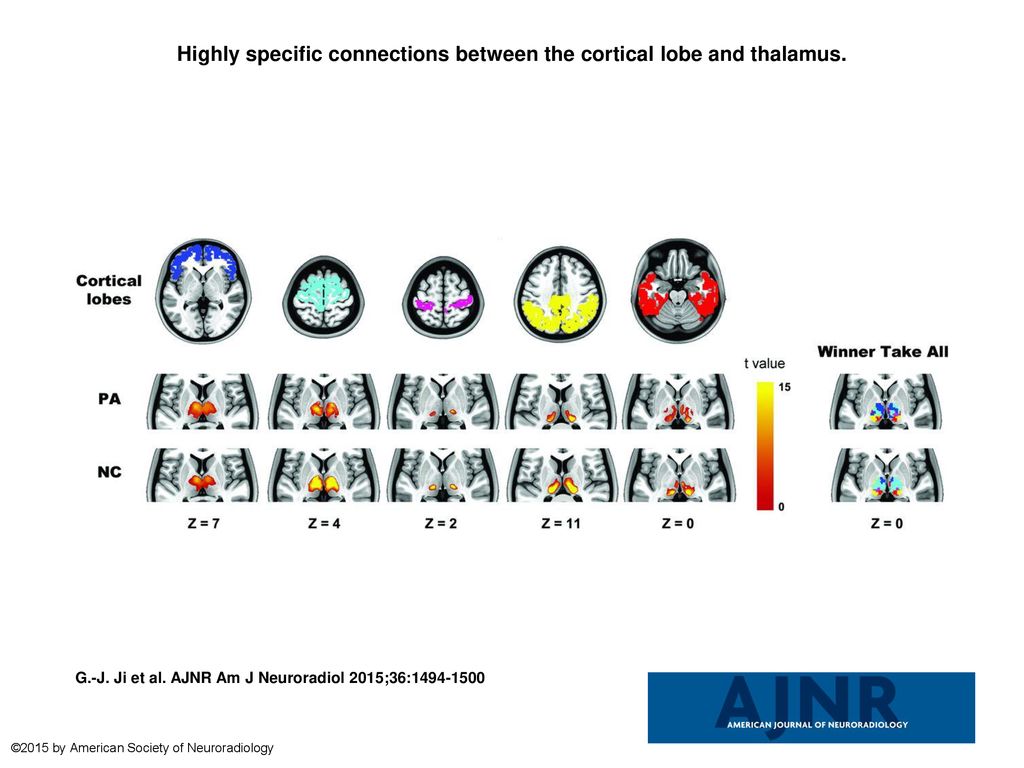 Highly specific connections between the cortical lobe and thalamus ... Biology Diagrams