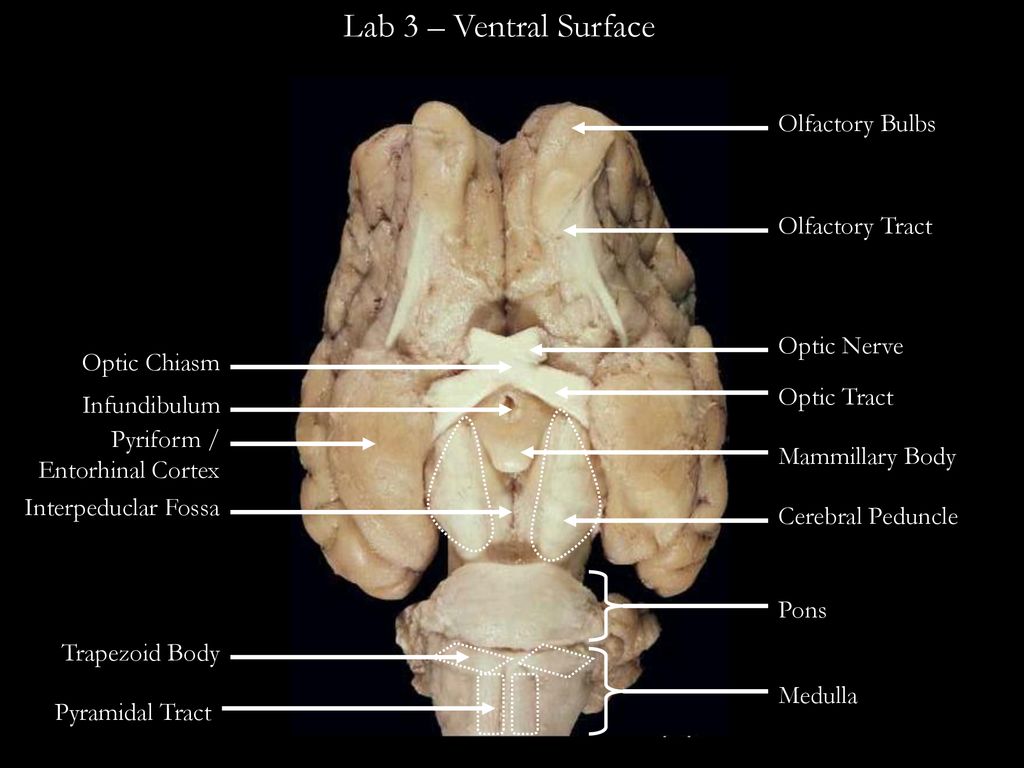 Lab 3 ventral surface olfactory bulbs olfactory tract optic nerve