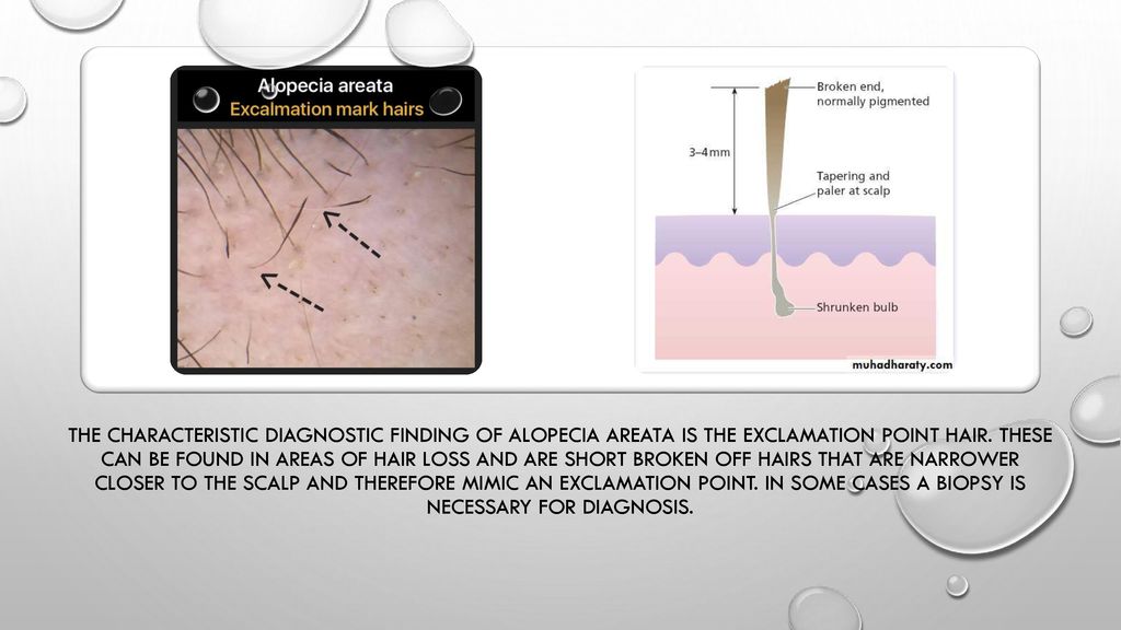 Scalp and hair conditions - ppt download