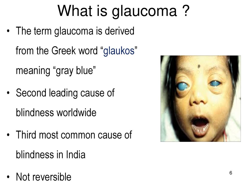 Introduction And Classification Of Glaucoma And Congenital Glaucoma Ppt Download