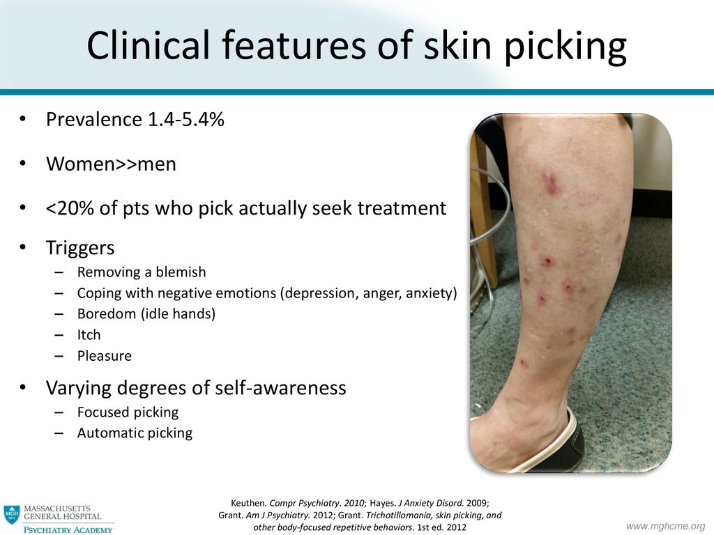 Skin Picking, Trichotillomania, and Hoarding - ppt download