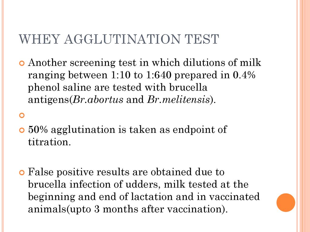 Milk and milk products adulteration | PPT