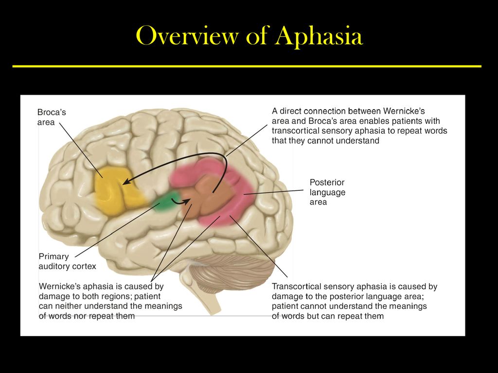 Афазия вернике. Broca Aphasia. Broca diagonal Band. Broca's Wernicke's Aphasia. Полость Вернике.