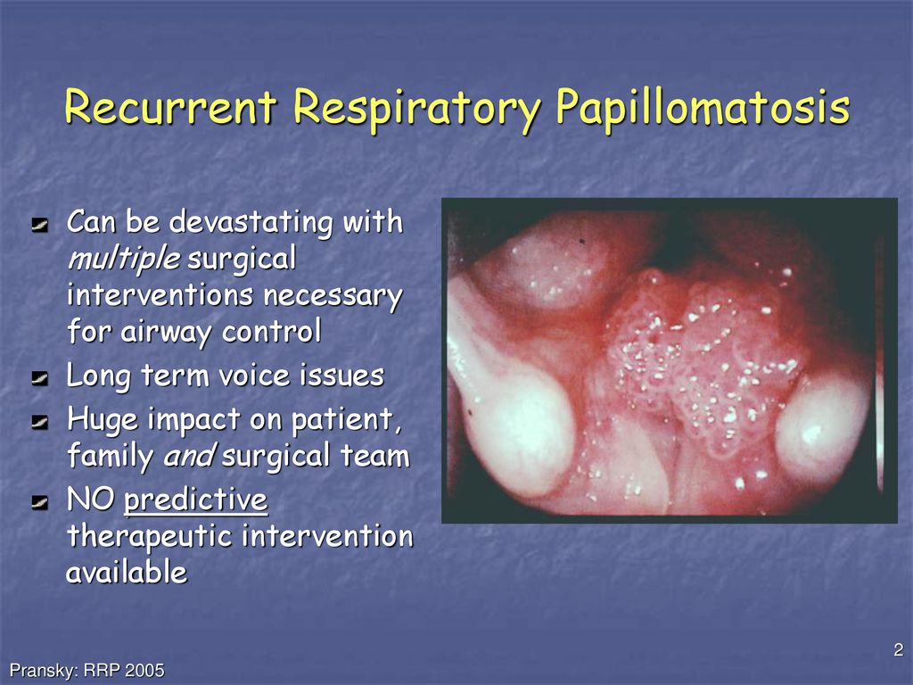 respiratory papillomatosis drug)