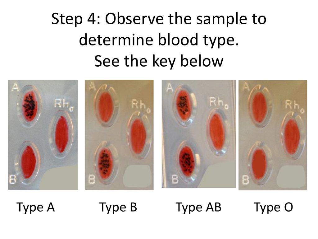 Lab activity determining blood type ppt download