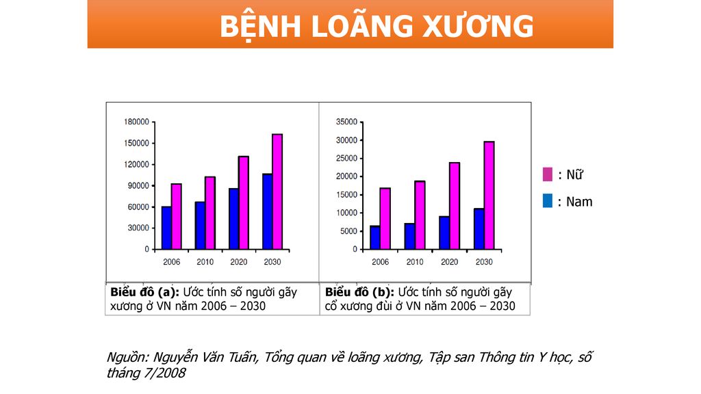 BỆNH LOÃNG XƯƠNG : Nữ : Nam