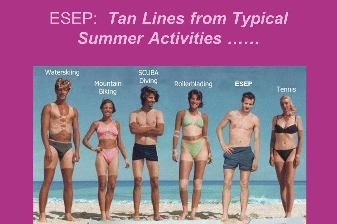 ESEP: Tan Lines from Typical Summer Activities.