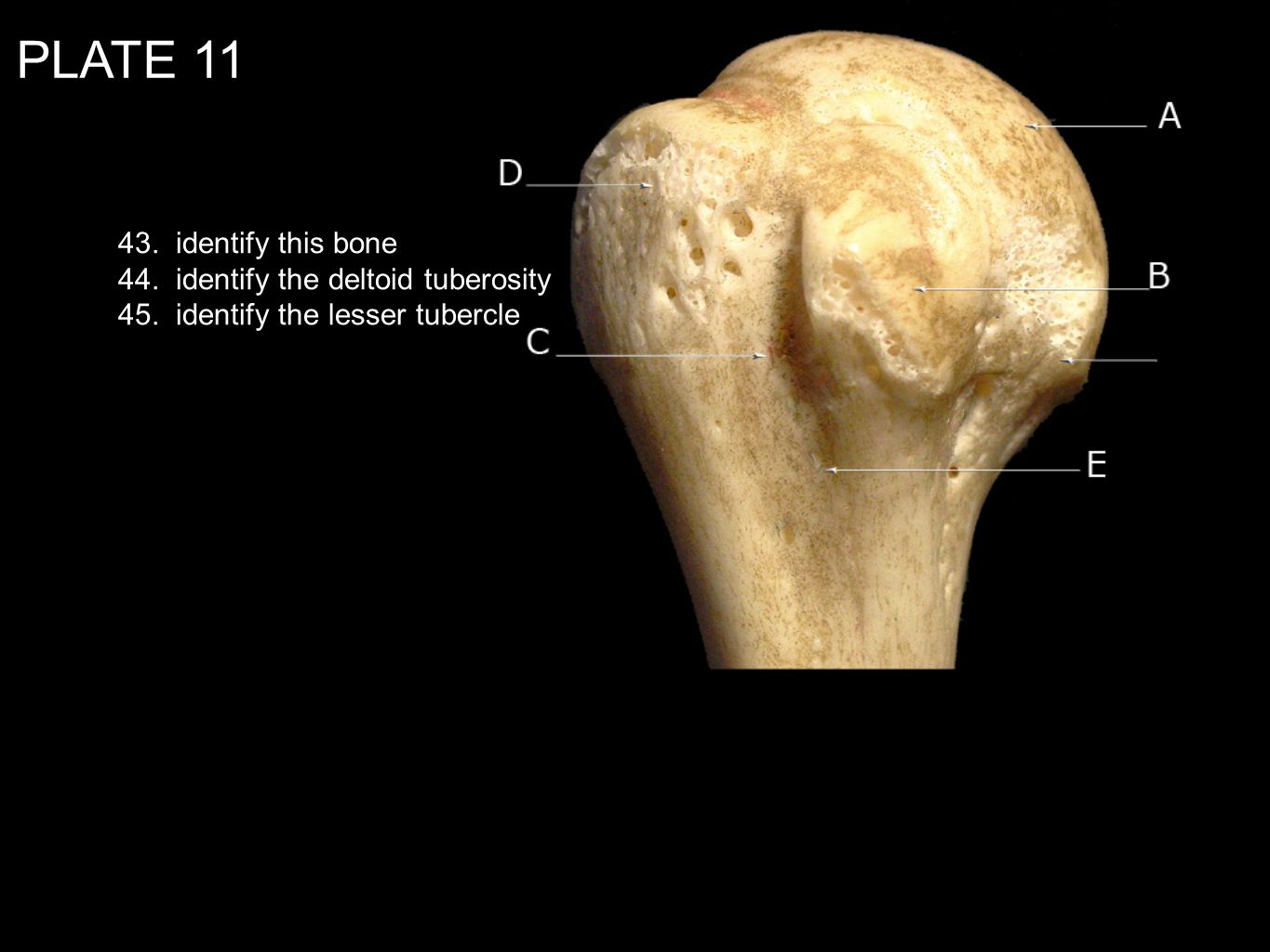 PLATE identify this bone 44. identify the deltoid tuberosity