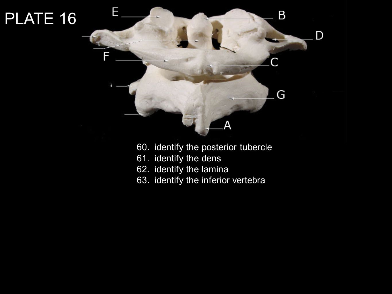PLATE identify the posterior tubercle 61. identify the dens