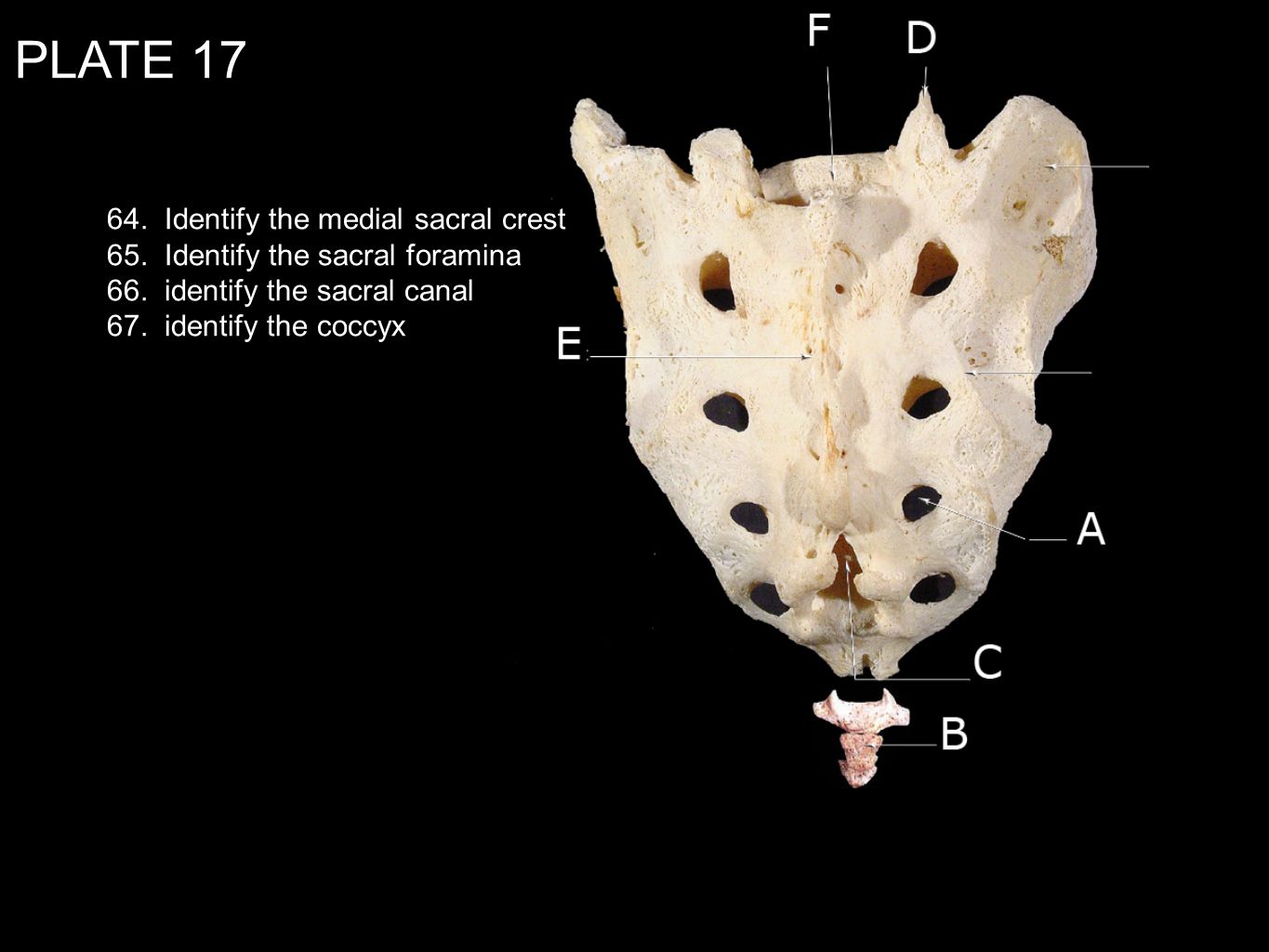PLATE Identify the medial sacral crest