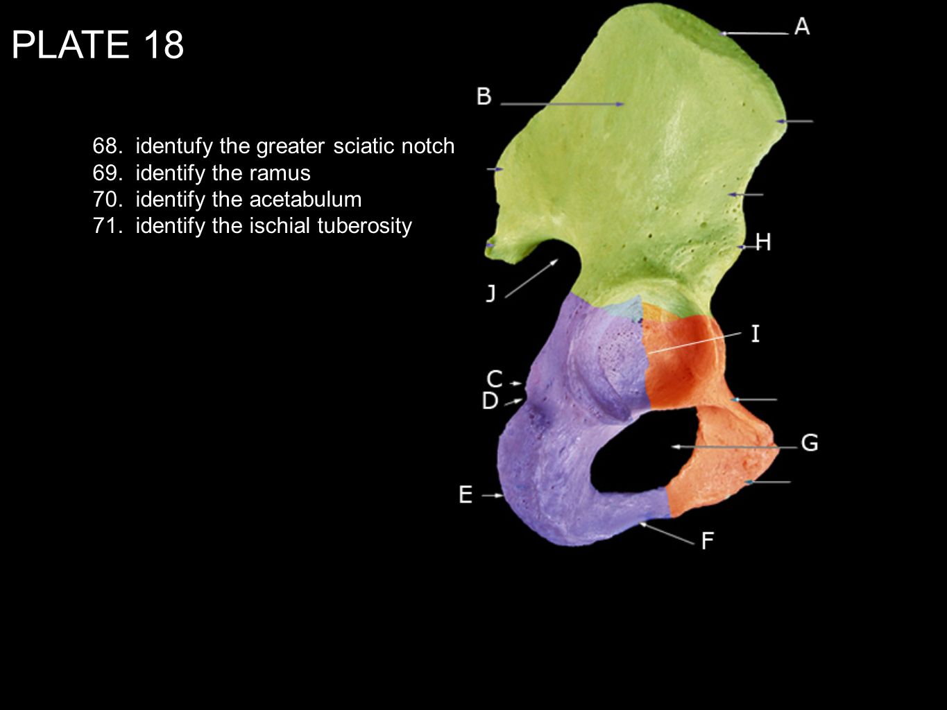PLATE identufy the greater sciatic notch 69. identify the ramus