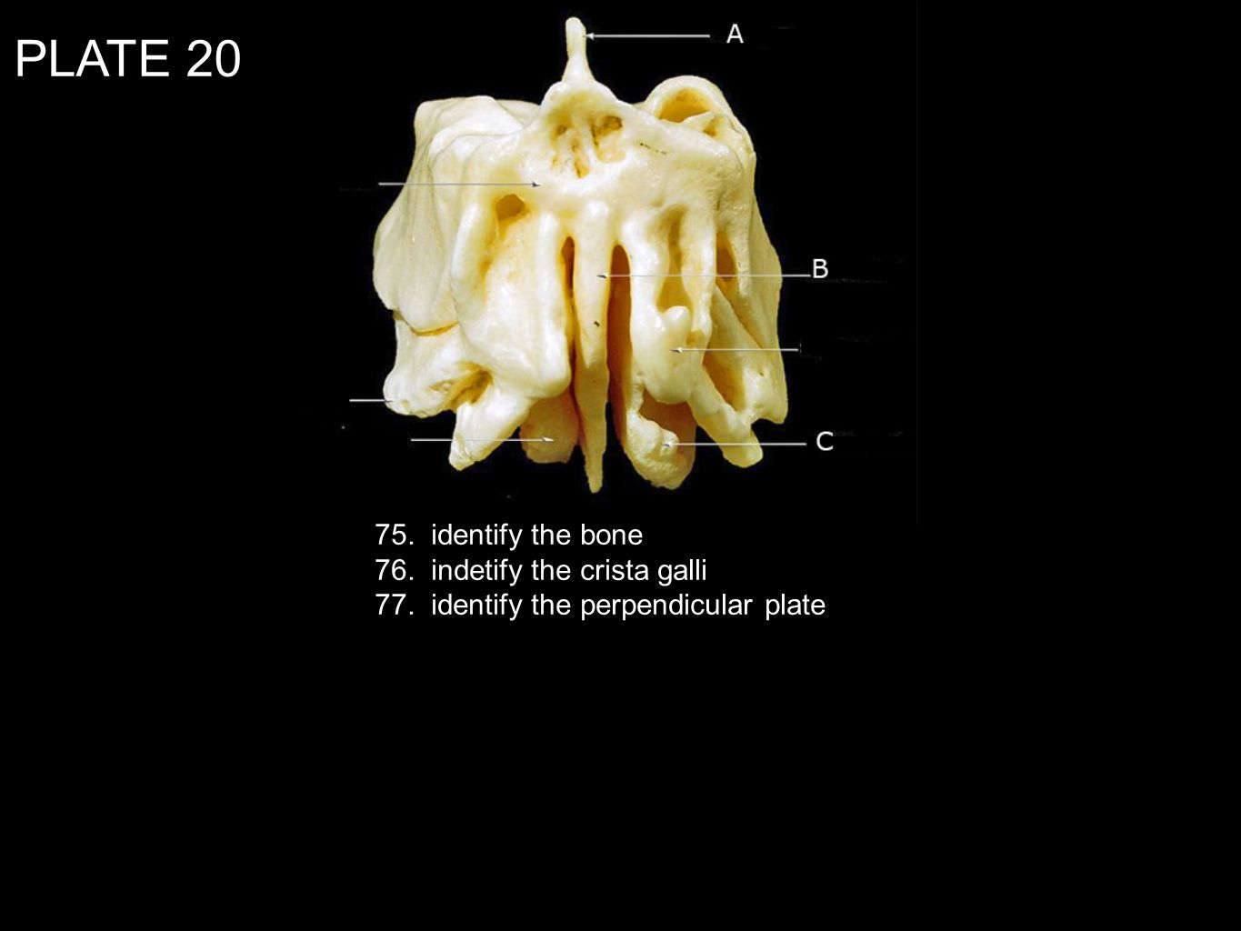 PLATE identify the bone 76. indetify the crista galli