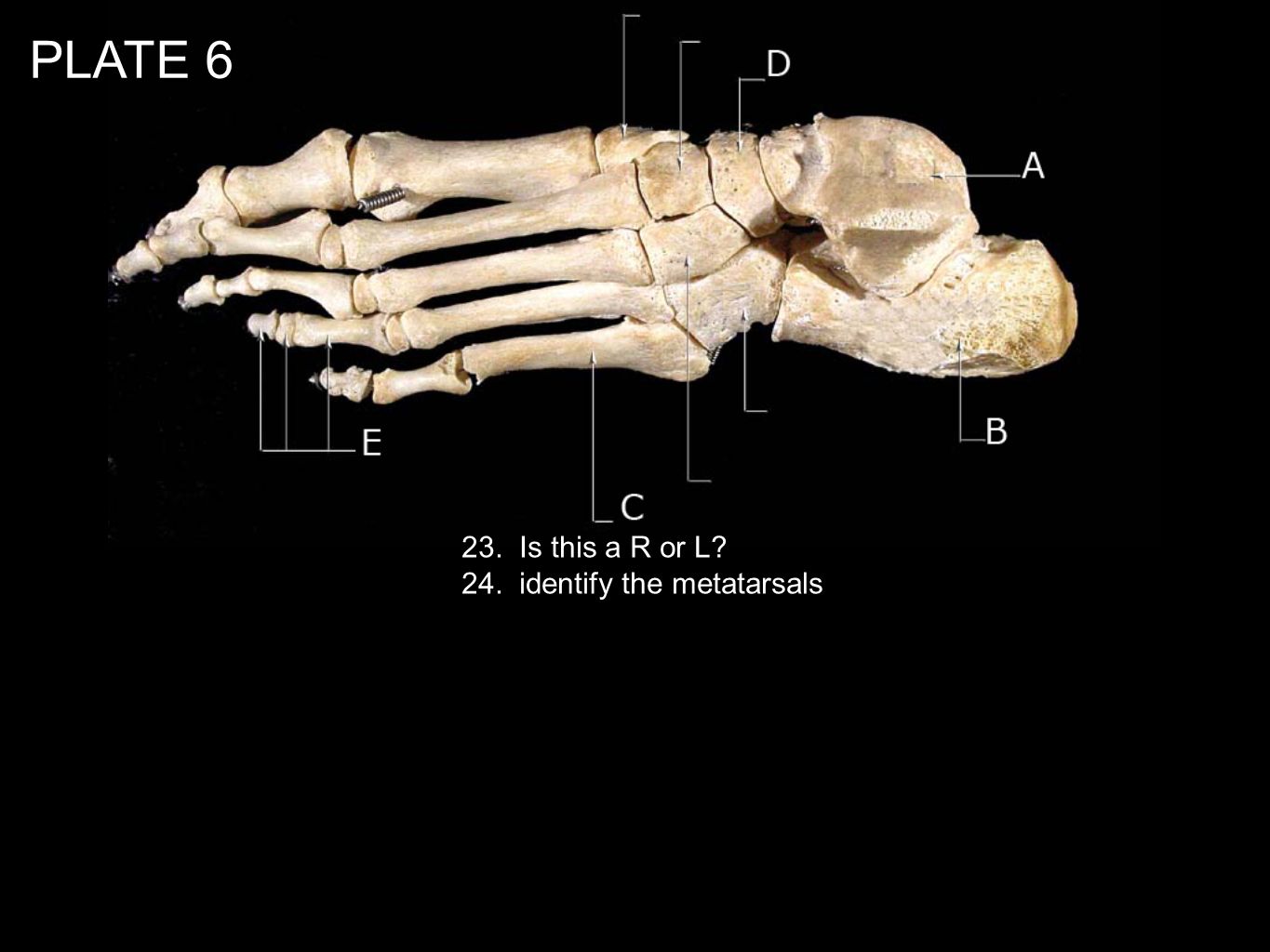 PLATE Is this a R or L 24. identify the metatarsals