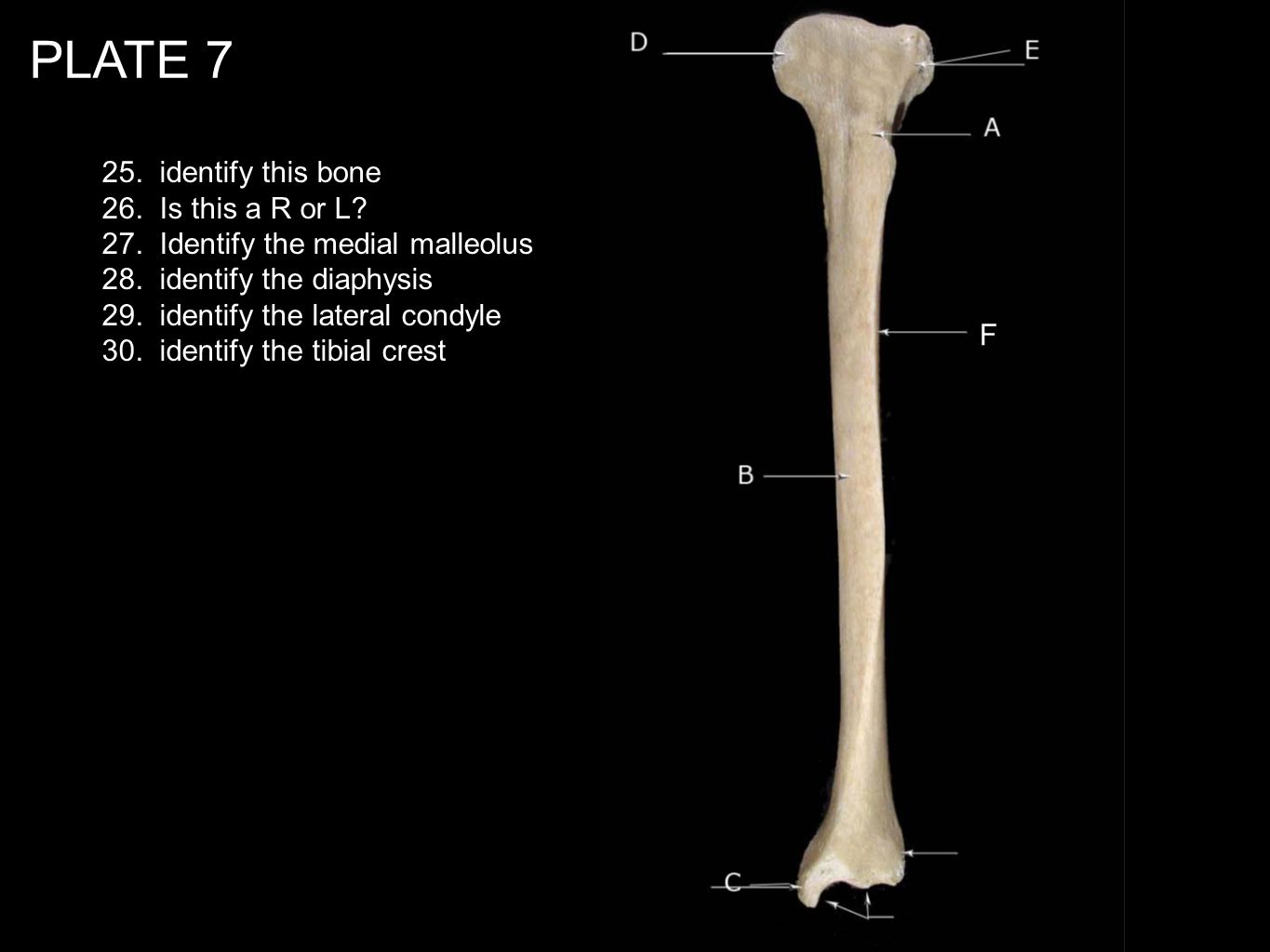 PLATE identify this bone 26. Is this a R or L