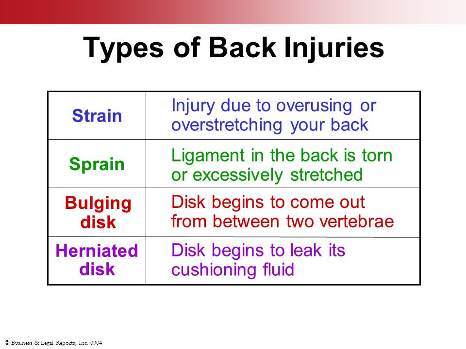 Types of Back Injuries Disk begins to leak its cushioning fluid