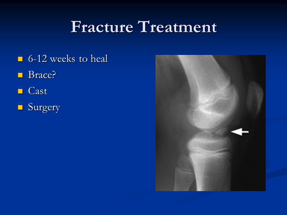 Fracture Treatment 6-12 weeks to heal Brace Cast Surgery