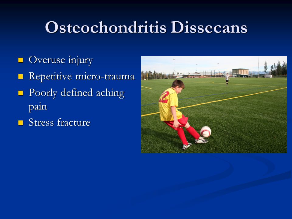 Osteochondritis Dissecans
