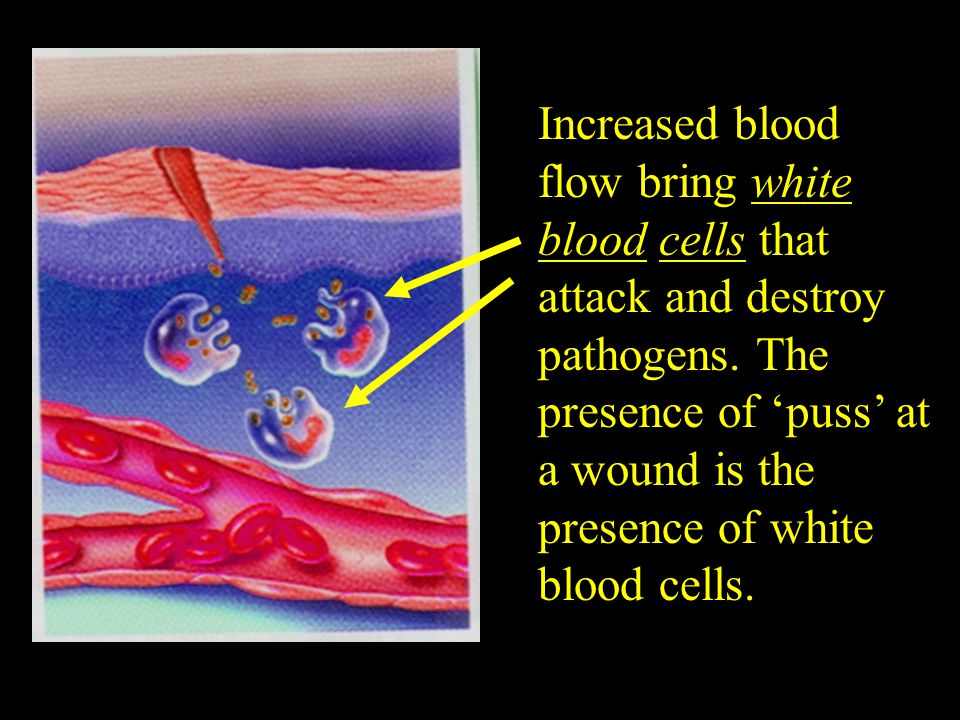 Increased blood flow bring white blood cells that attack and destroy pathogens.