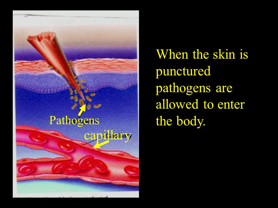 When the skin is punctured pathogens are allowed to enter the body.