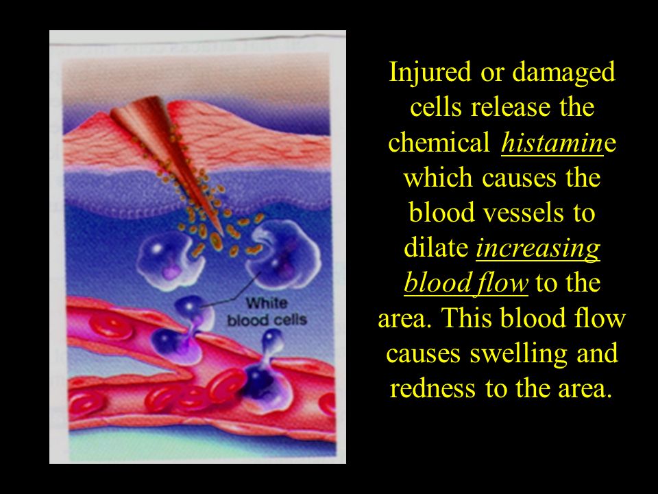 Injured or damaged cells release the chemical histamine which causes the blood vessels to dilate increasing blood flow to the area.