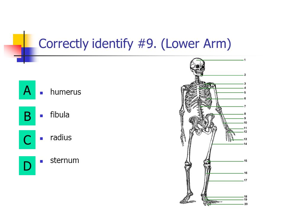 Correctly identify #9. (Lower Arm)