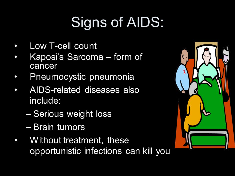 Signs of AIDS: Low T-cell count Kaposi’s Sarcoma – form of cancer