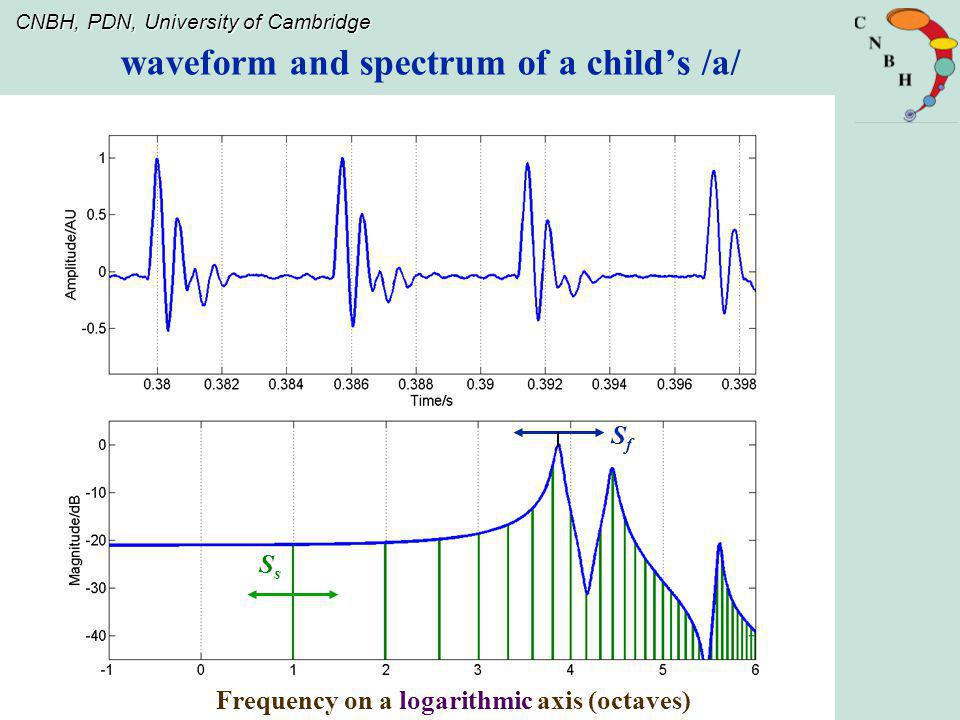 waveform and spectrum of a child’s /a/