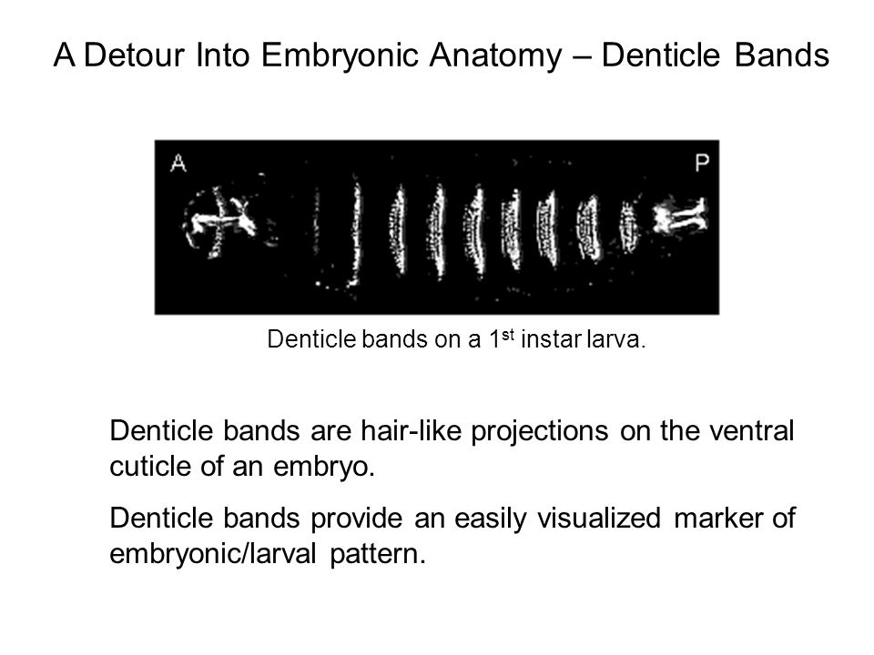 A Detour Into Embryonic Anatomy – Denticle Bands