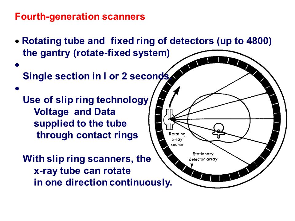 Slip Ring CT (Key Component of Modern 3rd Generation Computed Tomography) -  YouTube