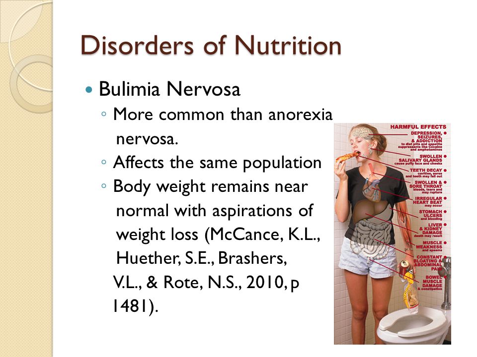 Disorders of Nutrition