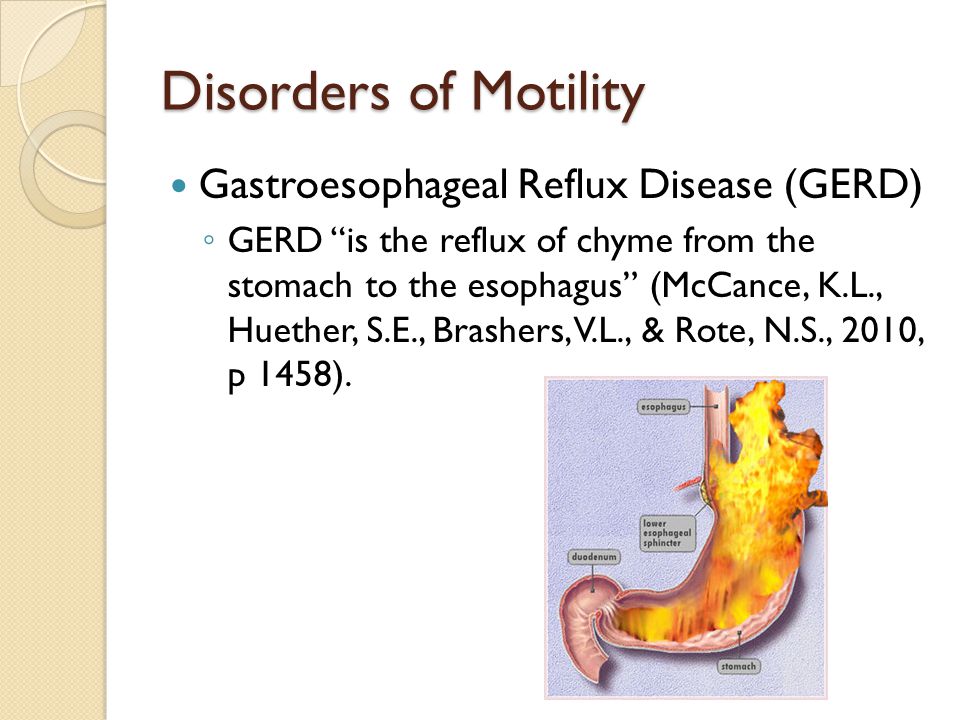 Disorders of Motility Gastroesophageal Reflux Disease (GERD)
